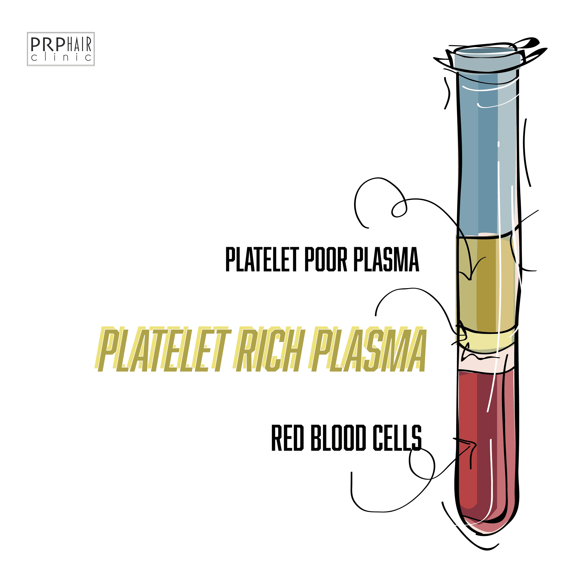 platelet rich plasma prp leicester